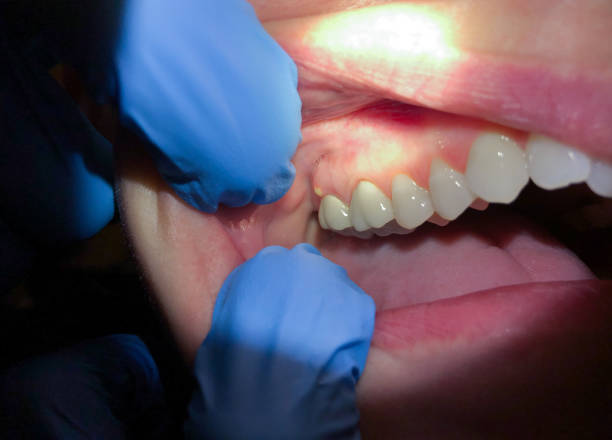 Best Dentist for Dental Trauma  in Woodmere, NY