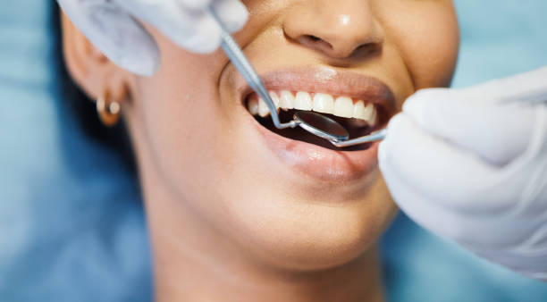 Dentist for Dental Trauma in NY