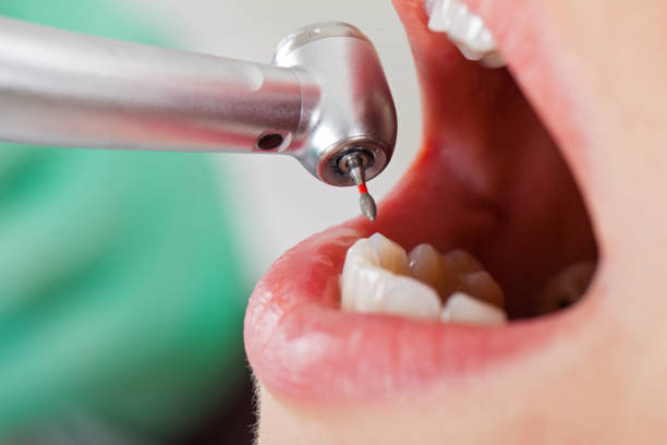 Best Dentist for Tooth Abscess  in Woodmere, NY